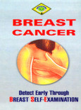 Breast Cancer